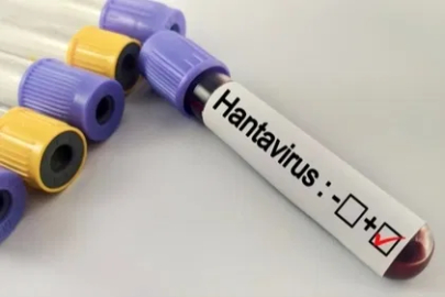 Hantavirüs salgına dönüşür mü? Kapalı alan temizliğinde büyük risk